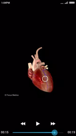 Cardiology-Animated Dictionary Zrzut ekranu 2